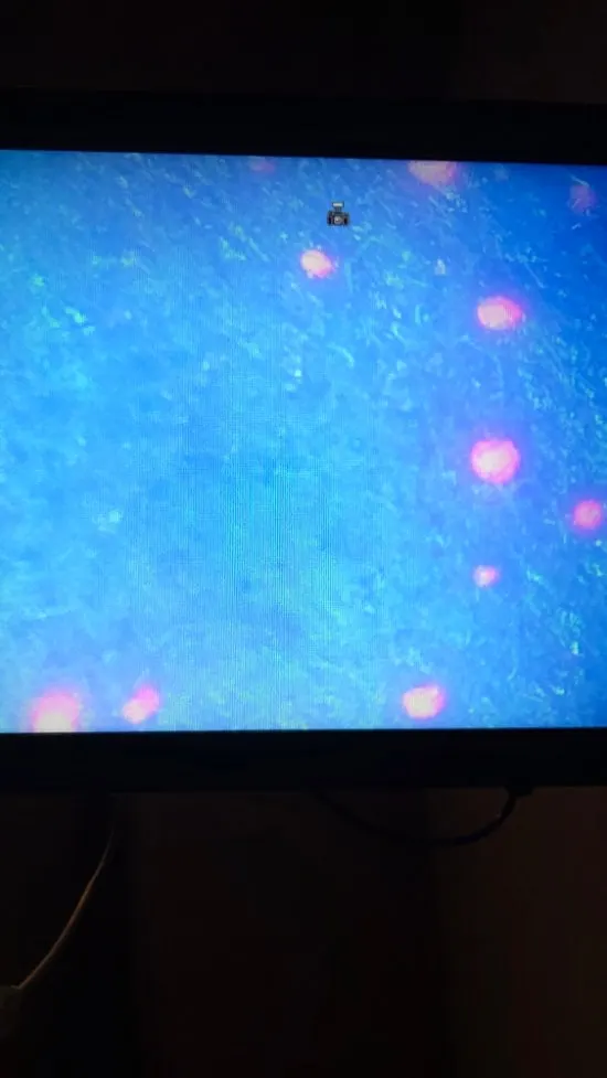 Zoomed-in skin scanning screen