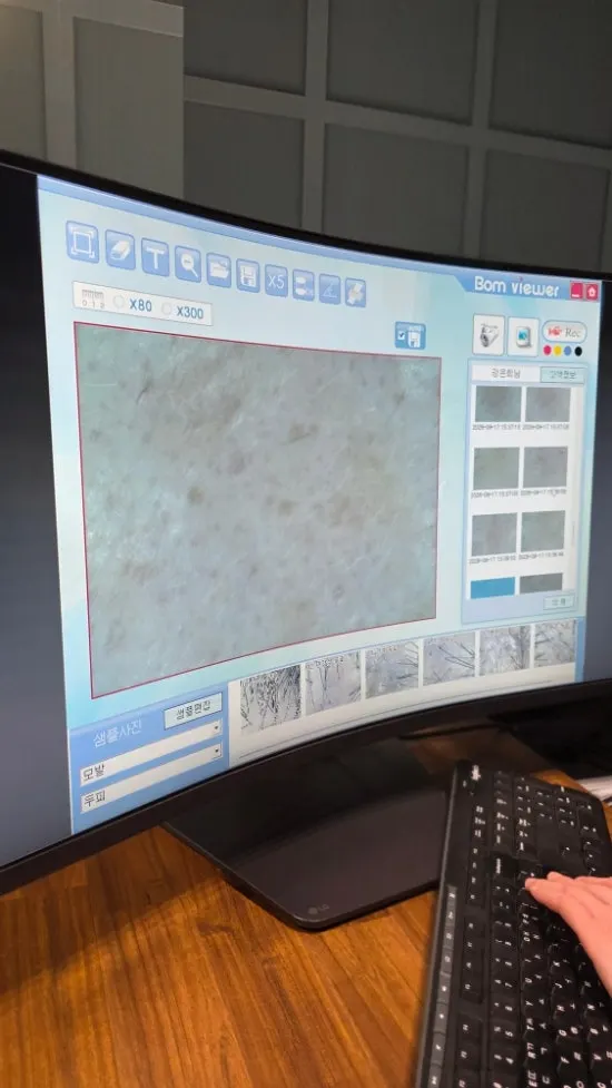 Comparison of zoomed-in skin surface scans