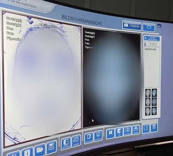 Consultation explaining the skin's heat buildup
