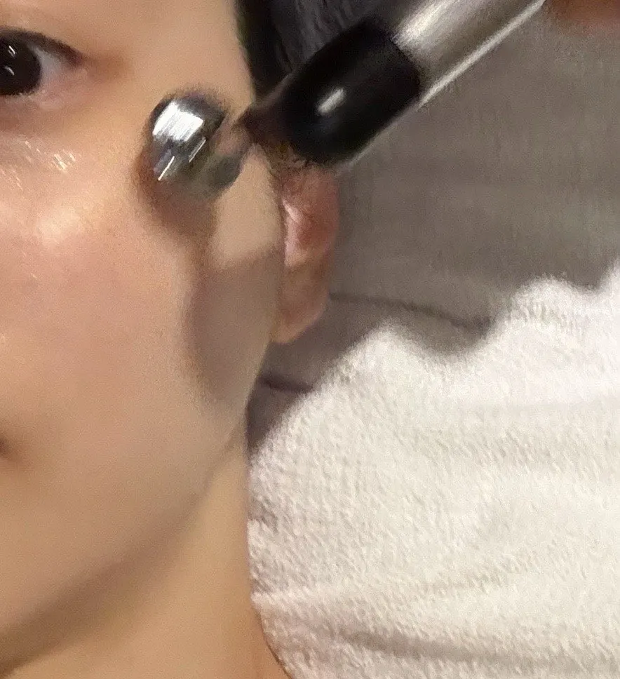 차가운 바람이 나오는 수소 주입 단계