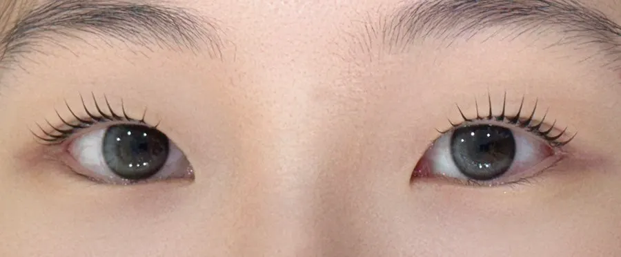 Comparison shot of both eyes' lashes before treatment