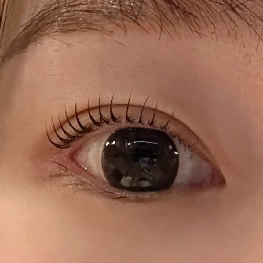 Eye look after treatment matching the double eyelid line