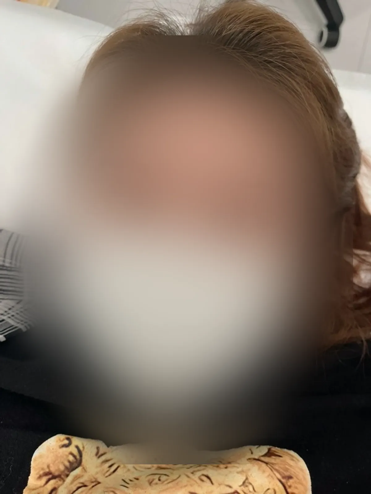 Lashes before treatment, tips bent from self-perming and eyelash curler use