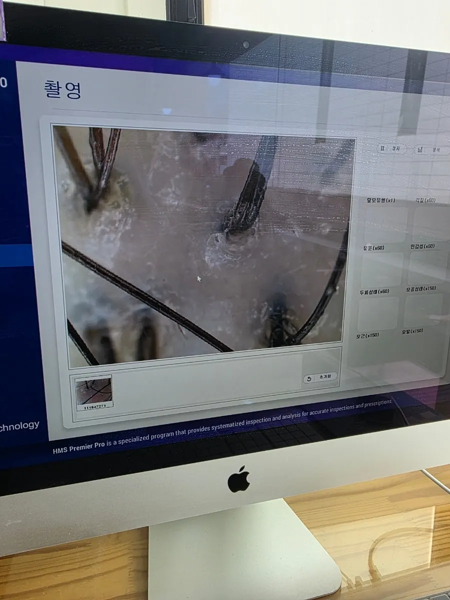 두피 상태 확인 과정