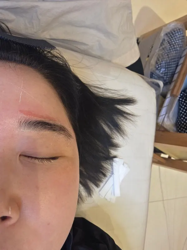 Eyebrows with gaps from self-cutting