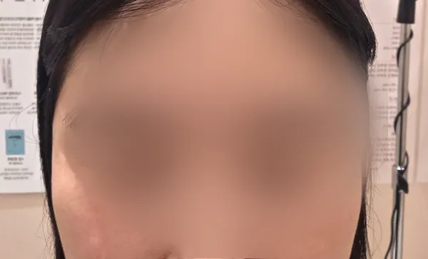 Before and after comparison photo of eyebrow waxing