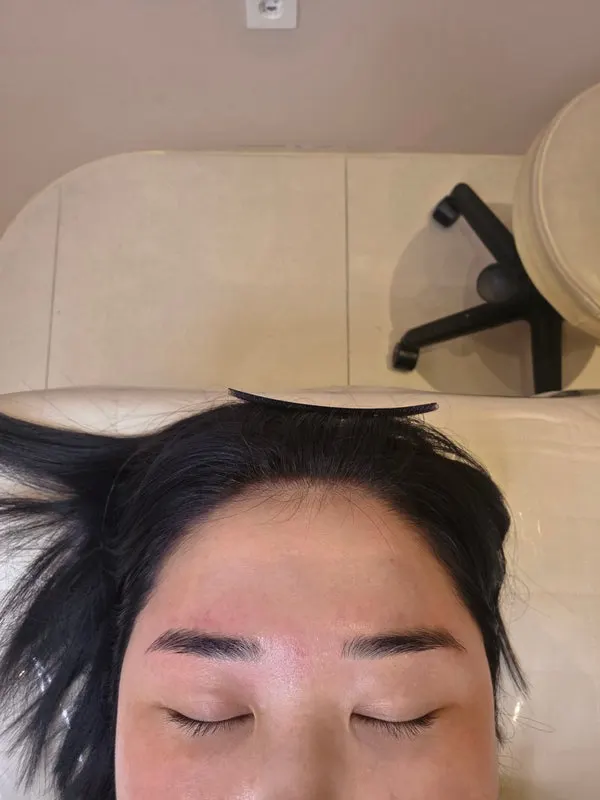 After photo showing a sharper eyebrow line