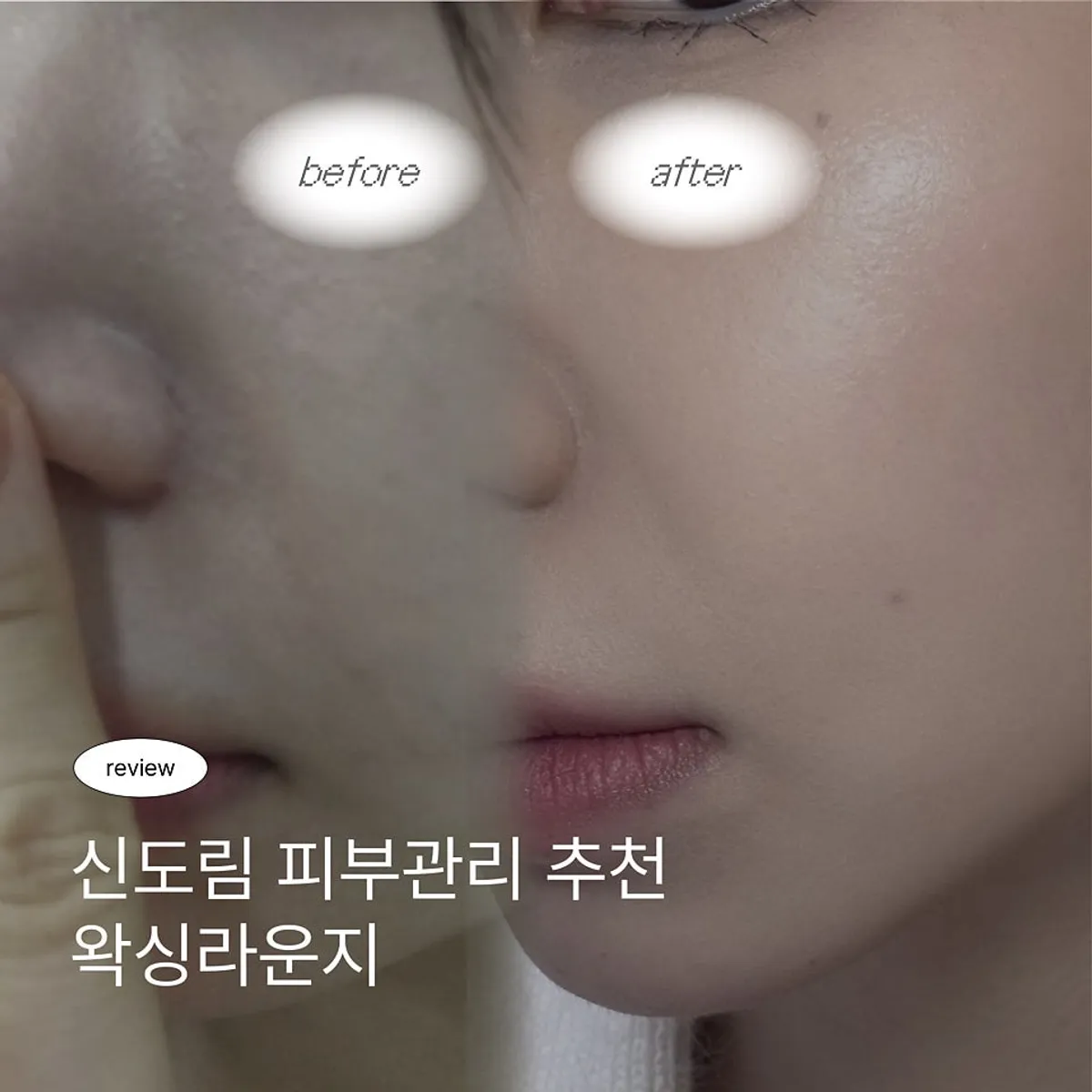 Selfie taken after the treatment