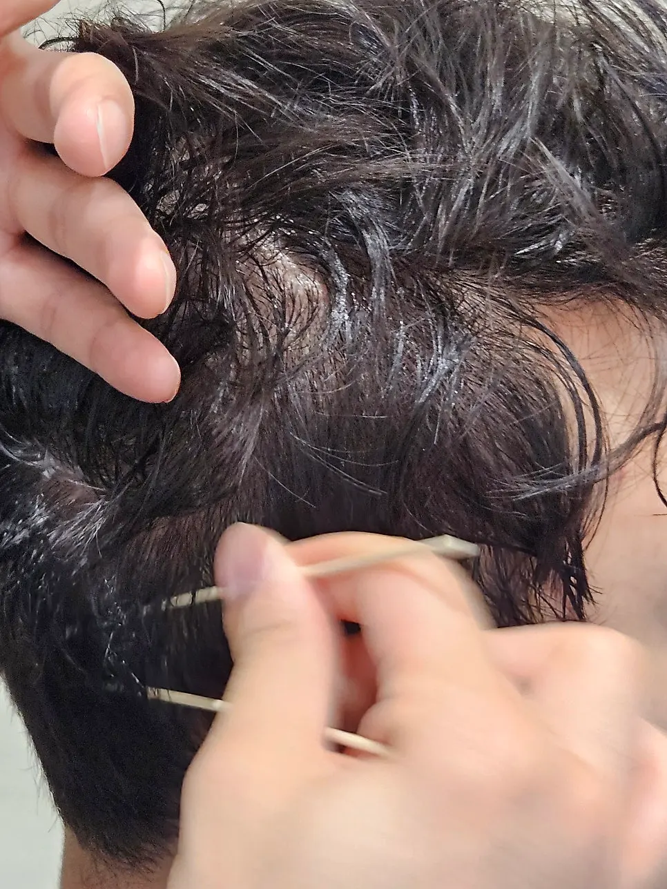 Step 2 scaling to clear buildup and dead skin cells