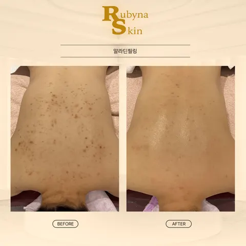 루비나 피부&바디 매장 사진 2/16