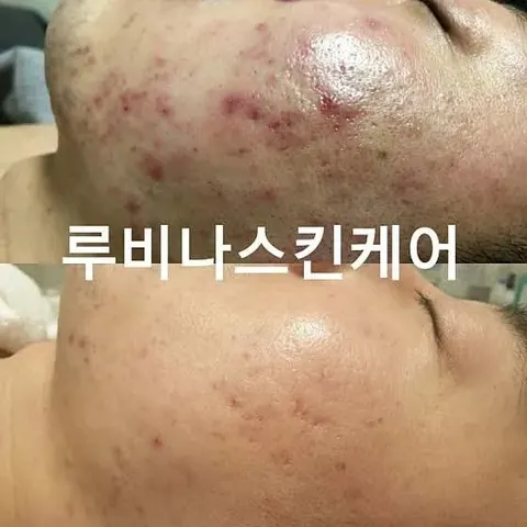 루비나 피부&바디 매장 사진 10/16