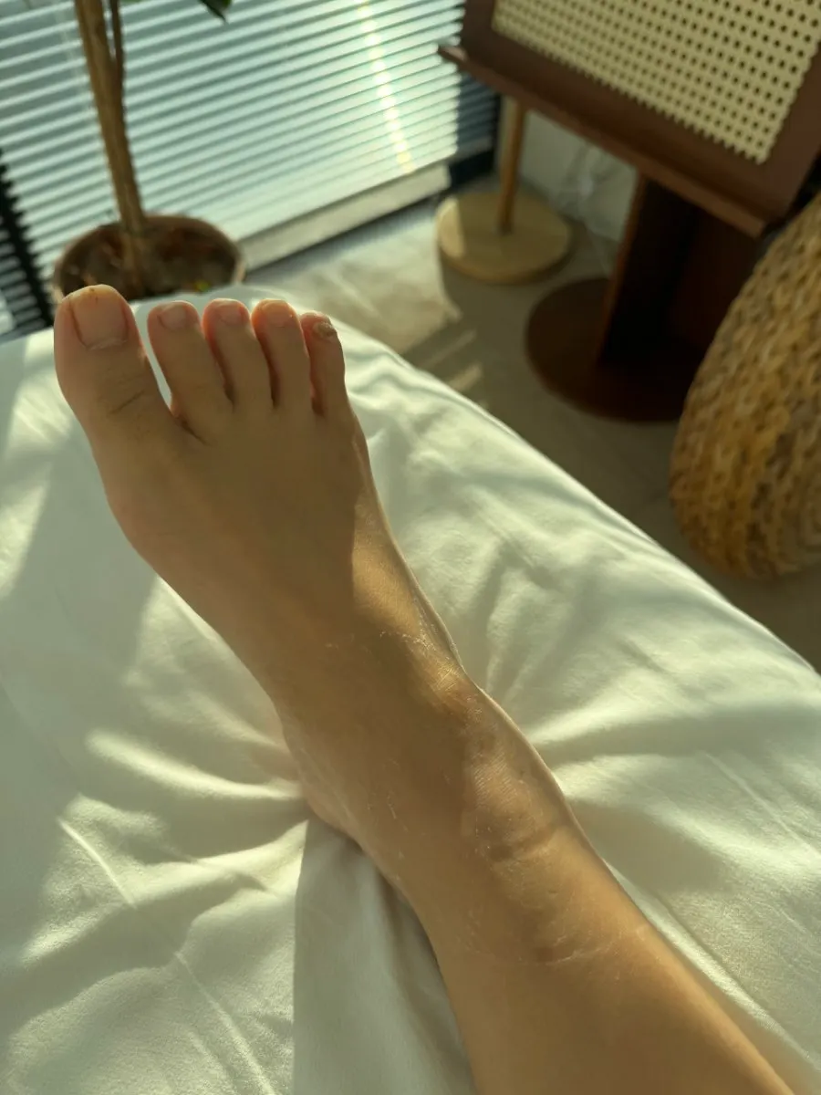 통증이 있던 오른발 바깥쪽과 새끼발가락 부위