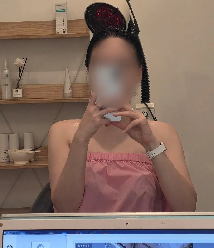 모공당 모발 수를 확인한 두피 확대 이미지