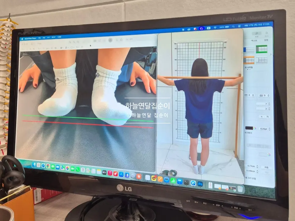 검진 영상을 보며 설명을 듣는 상담 모습