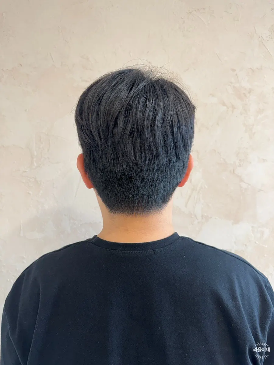 시술 전 뒷머리와 목 뒤 라인