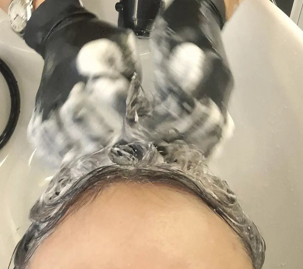 Careful scalp treatment across the whole head