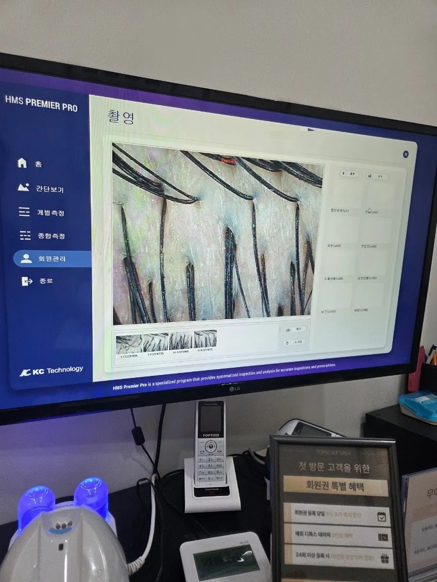 두피 확대 카메라로 진행하는 맞춤 상담