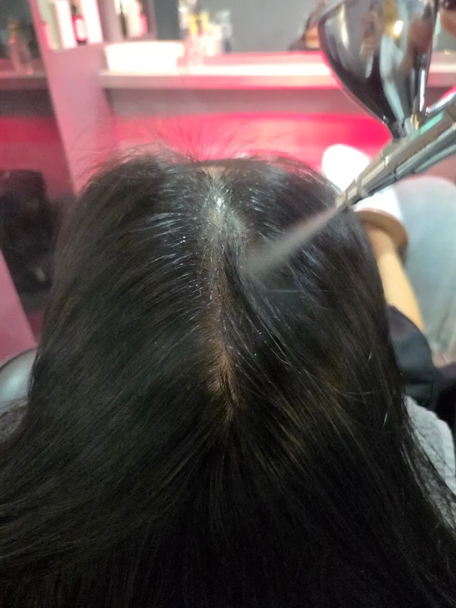고농축 앰플을 도포하는 마이크로라이저 관리