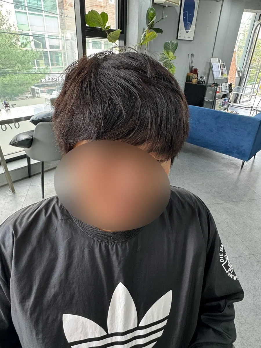 시술 전 덥수룩하게 길어진 남자 머리