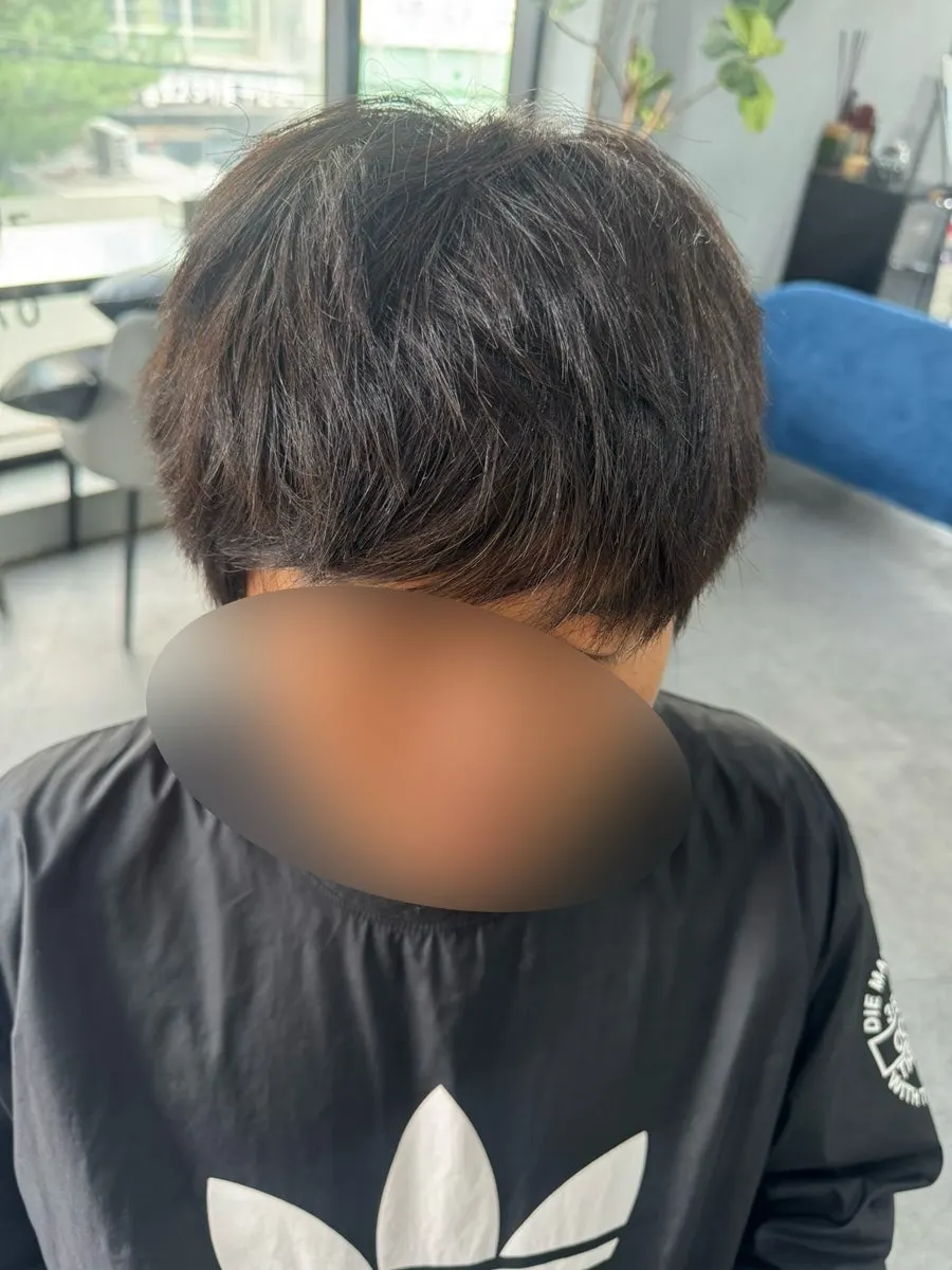 시술 전 뒷머리 길이 확인
