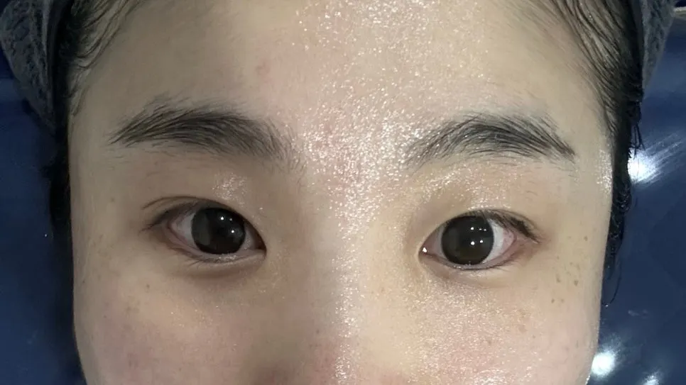 Treatment process after the facial massage