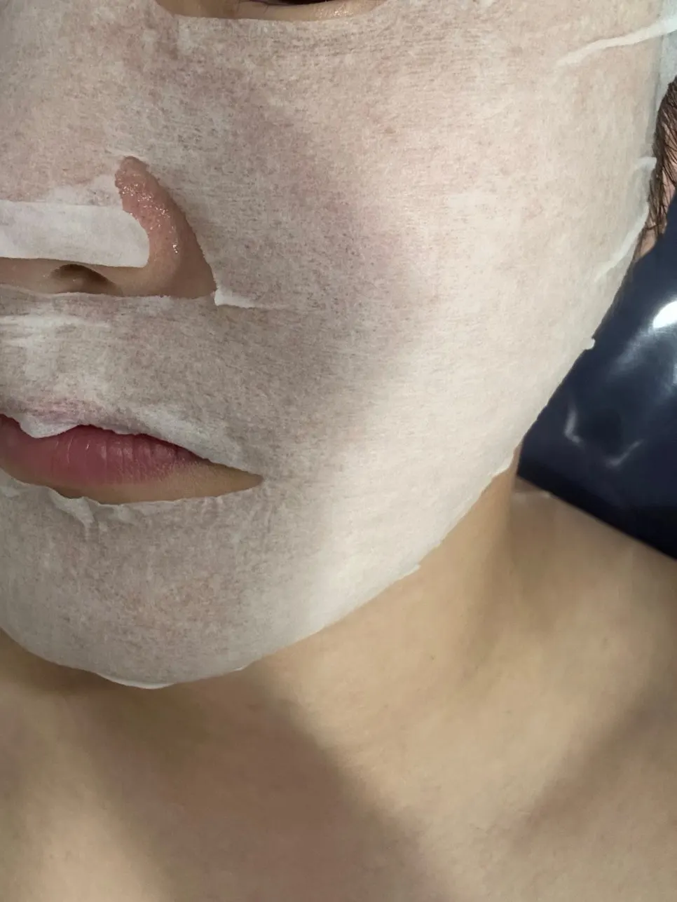 Before-and-after comparison of face-line care
