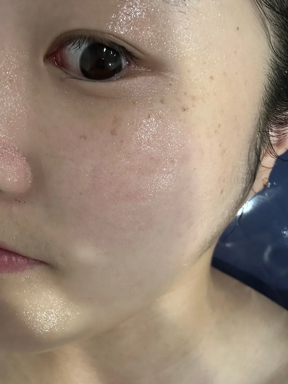 Healing House treatment space after face-line care