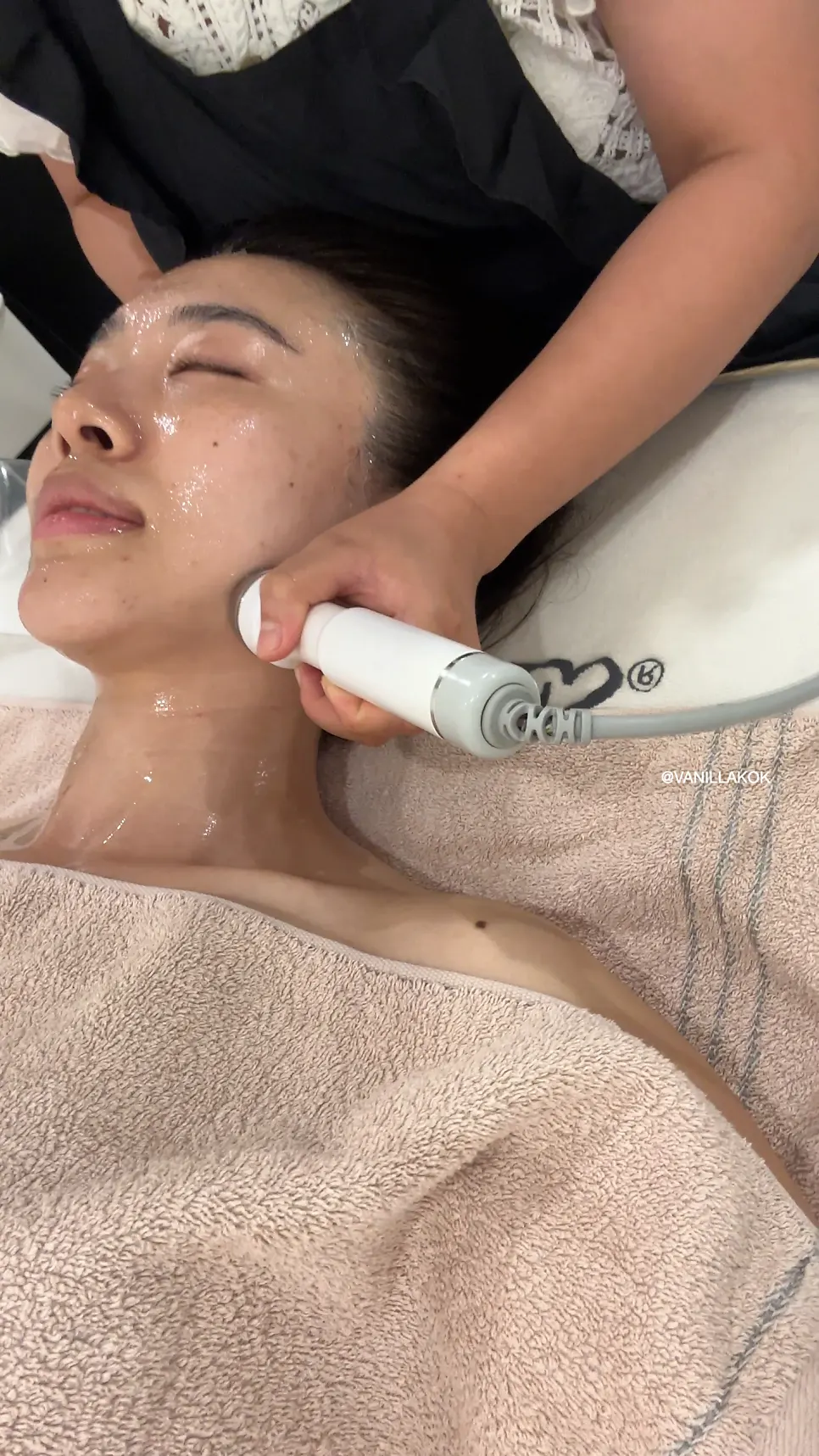 Facial asymmetry contour care in progress