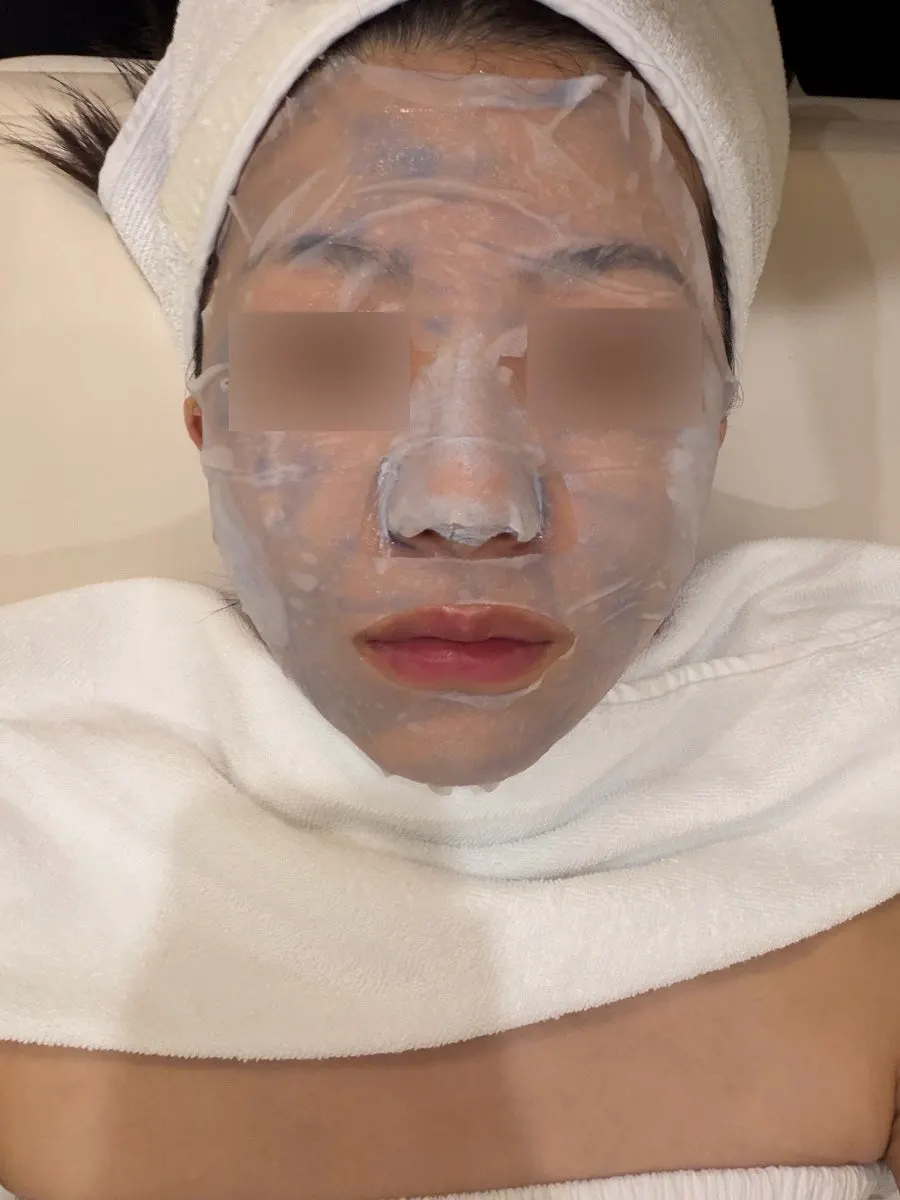 국소 부위에 도포된 진정 클레이 마스크