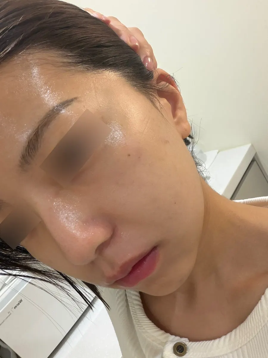 마스크팩 부착 후 진행된 데콜테 관리