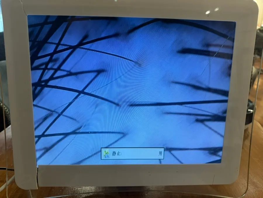 확대해서 확인한 두피와 모발 상태