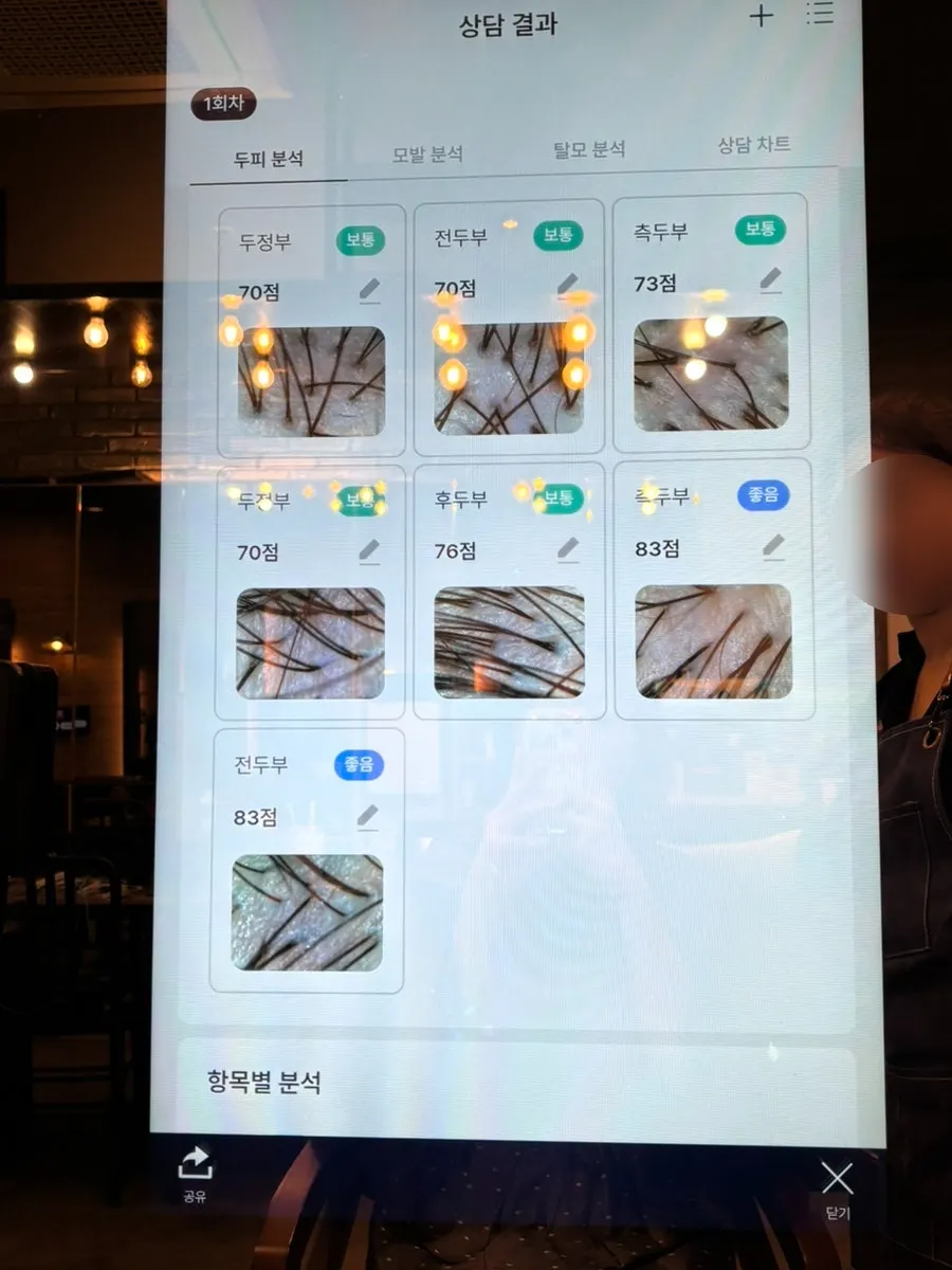 상담 시작 전 두피 진단 화면
