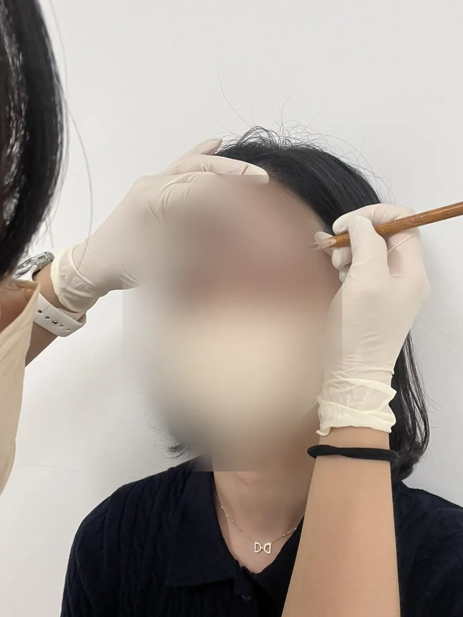 리터치 조건이 안내된 시술 동의 서류