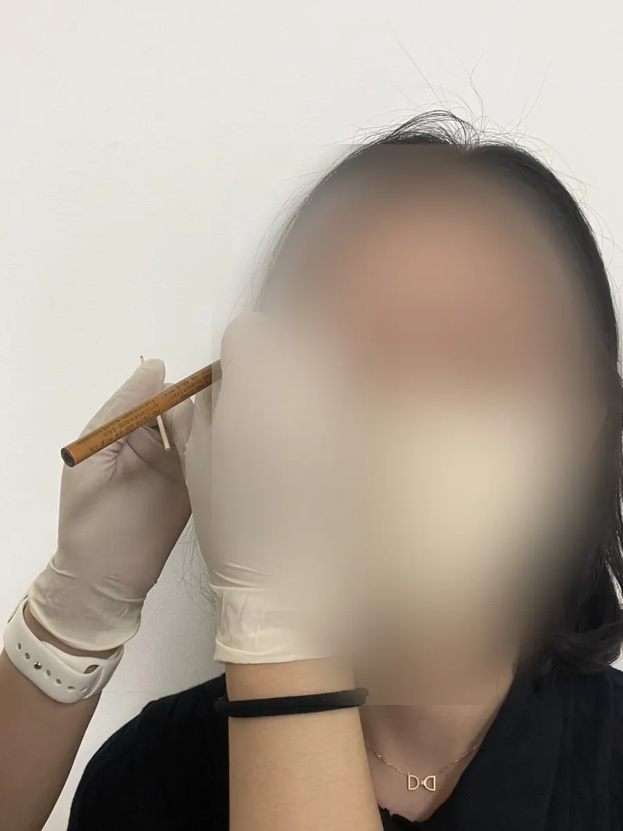 마취 후 눈썹 디자인 잡는 과정
