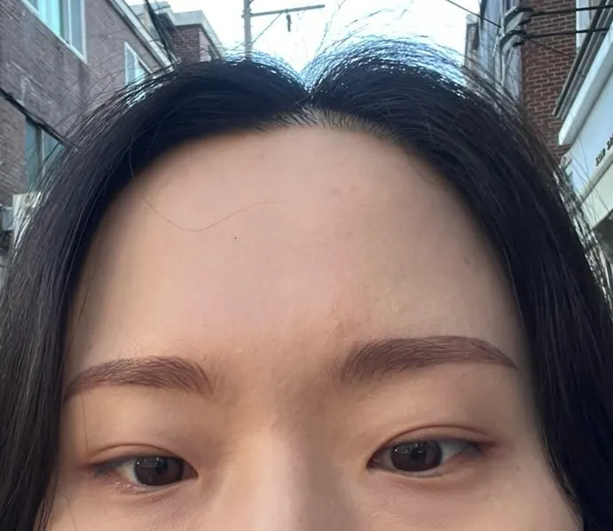 시술 다음날 색소가 올라온 눈썹