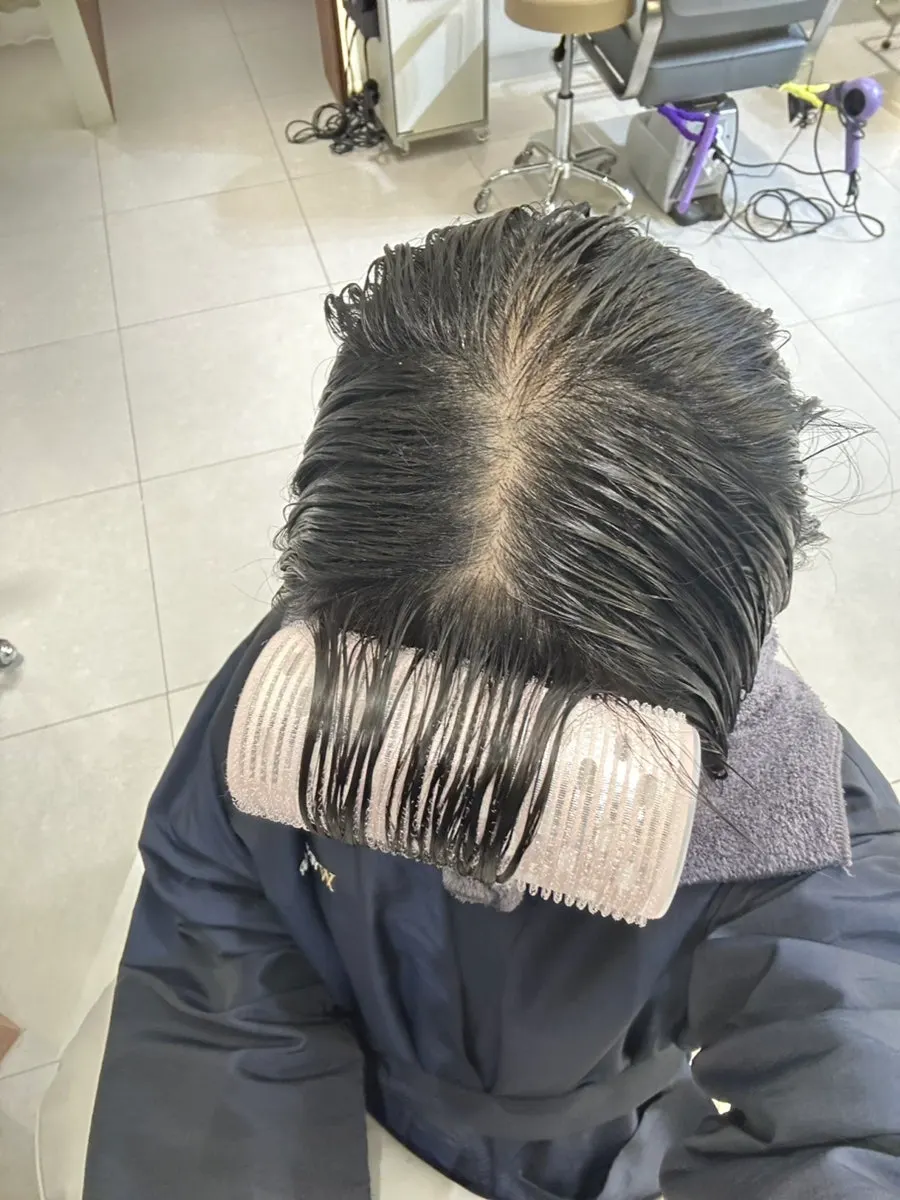 Back hairline correction work underway