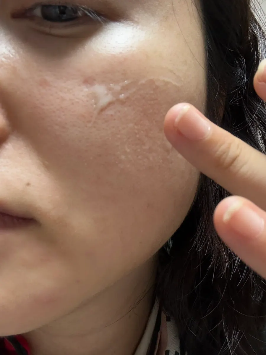 Skin tone looking more even after using the ampoule