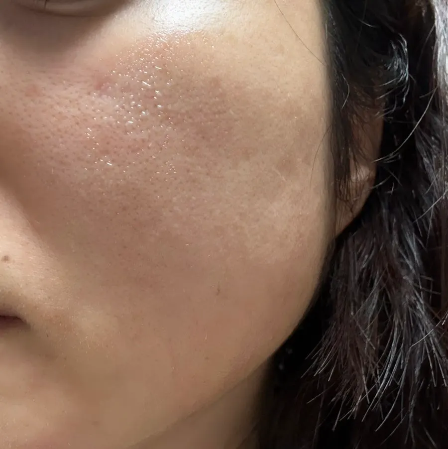 Using Yunoa Melabler as a daily ampoule